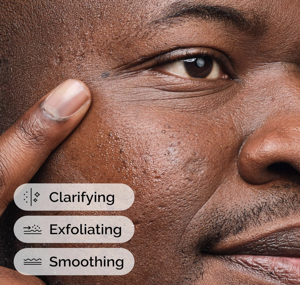 The Ordinary Solución de ácido salicílico al 2%, suero para combatir el acné para piel propensa a imperfecciones