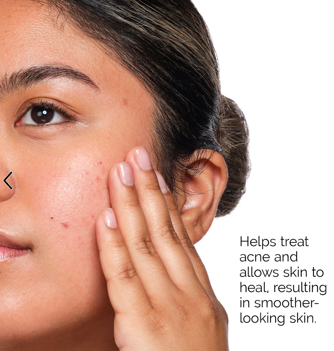 The Acne Set The ordinary