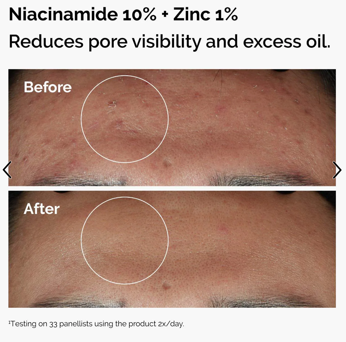 Acido Hialurónico 30 Ml + Niacinamide 30ml Set The Ordinary Tipo De Piel Todo Tipo De Piel