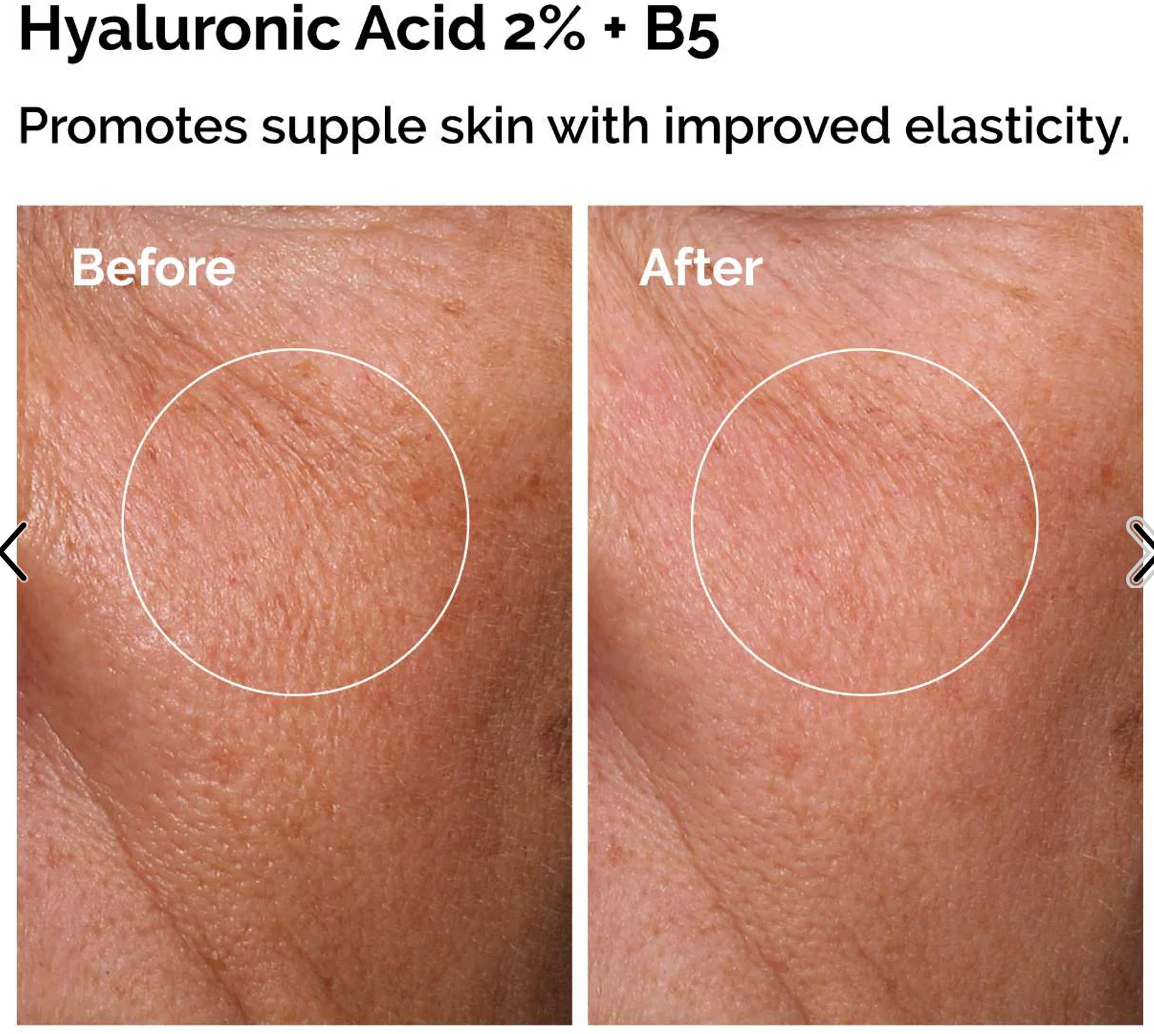 Acido Hialurónico 30 Ml + Niacinamide 30ml Set The Ordinary Tipo De Piel Todo Tipo De Piel