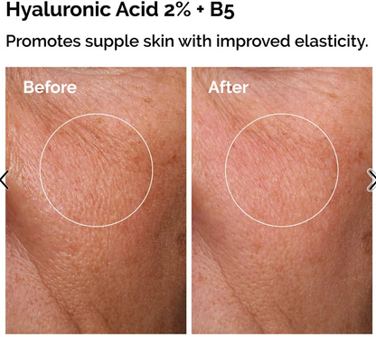 Acido Hialurónico 30 Ml + Niacinamide 30ml Set The Ordinary Tipo De Piel Todo Tipo De Piel