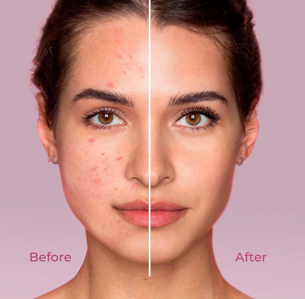 Aceite Desmaquillante de Arroz