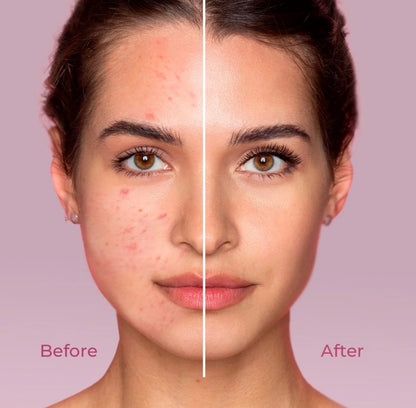 Aceite Desmaquillante de Arroz